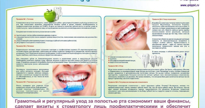 Правила ухода за зубами для предотвращения кариеса и пародонтоза