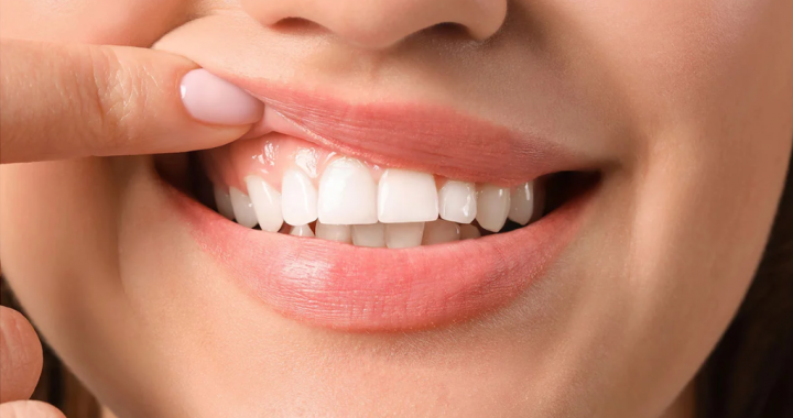 Как улучшить здоровье зубов и десен